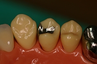 �C�����[